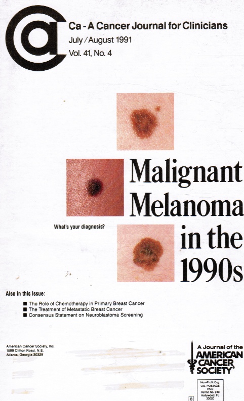 Image for Ca-A Cancer Journal for Clinicians : Vol 41, No 4 July/Aug 1991 Malignant Melonoma in the 1990's