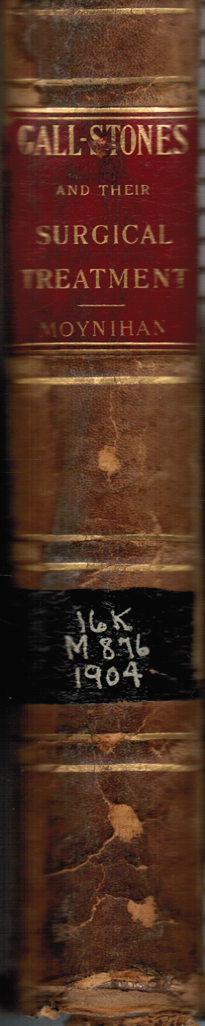 Image for Gall-Stones and Their Surgical Treatment